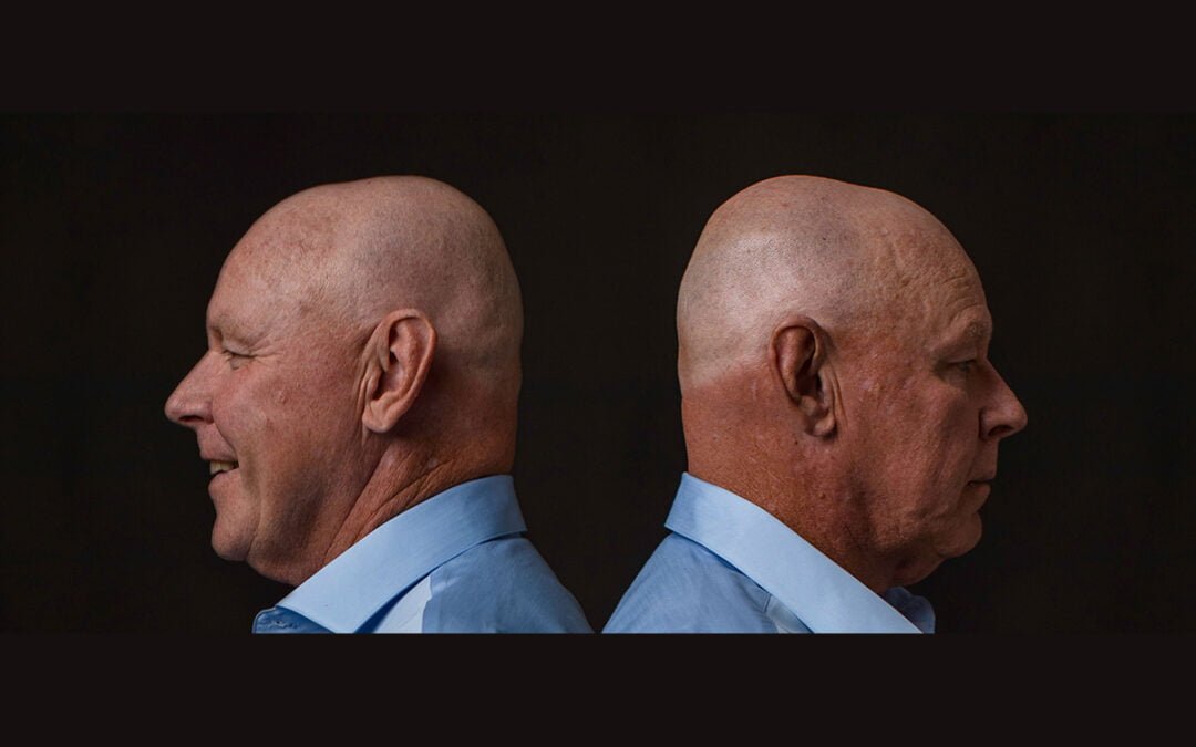 Imagine if your Mind was Free